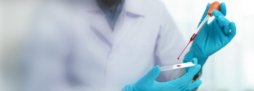 Kraftlos und krank? So helfen kleines und großes Blutbild