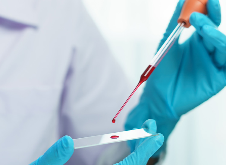 Kraftlos und krank? So helfen kleines und großes Blutbild